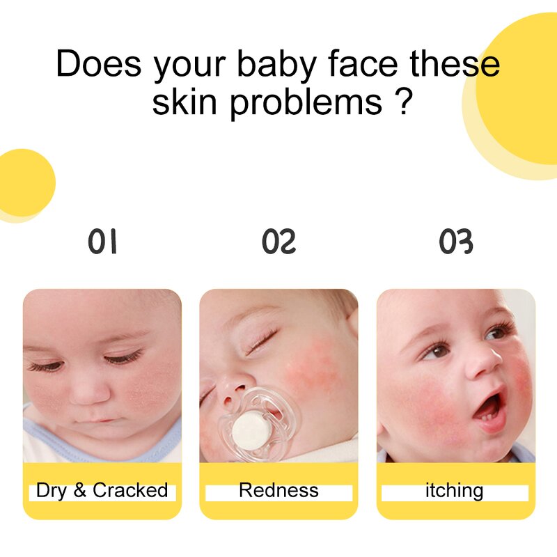 Baby Face Cream Manufacturer - Private Label Calendula