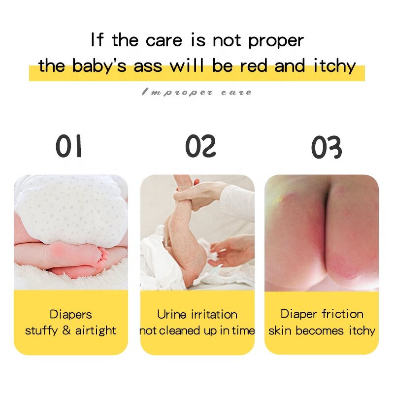 Baby Diaper Cream Manufacturer - Healing Ointment