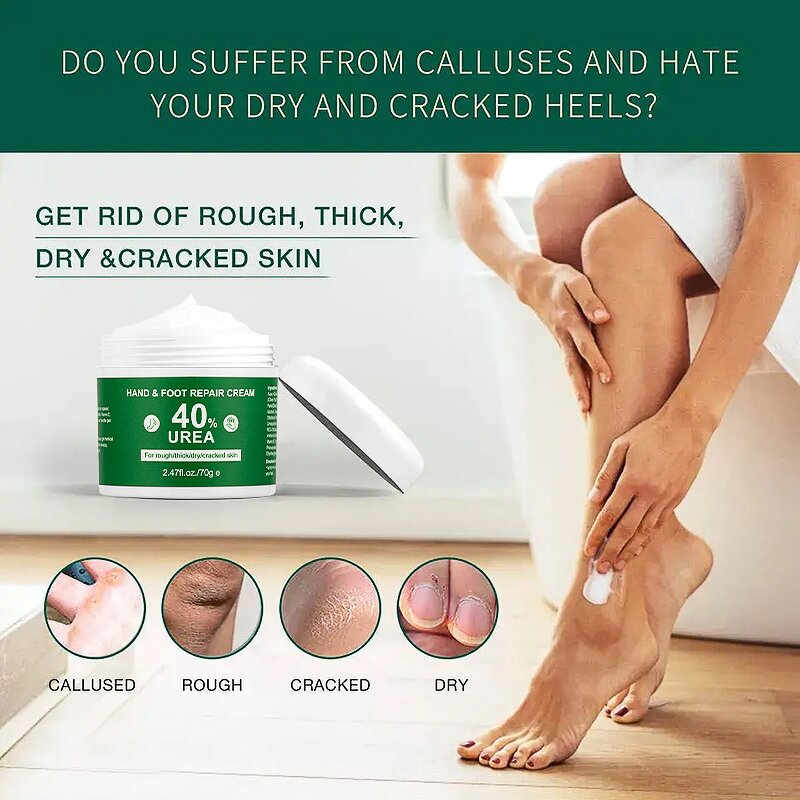 Foot Cream Manufacturer - Custom Anti Crack Shea