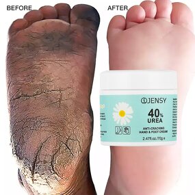 Foot Cream Manufacturer - Cracked Heels Repair
