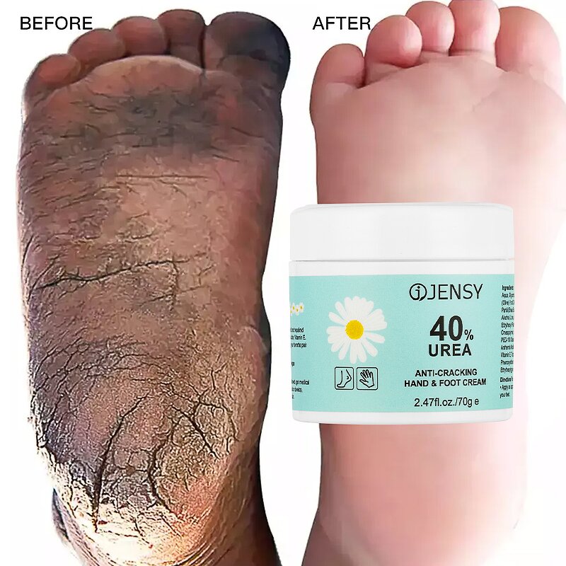 Foot Cream Manufacturer - Cracked Heels Repair