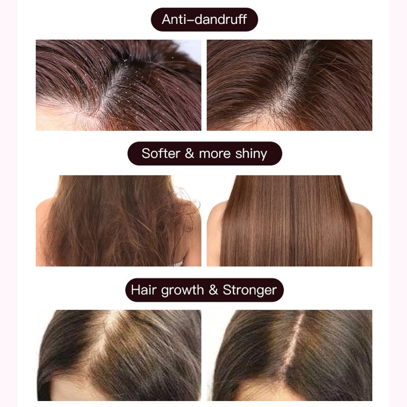 Hair Care Set Manufacturer - OEM Anti Dandruff