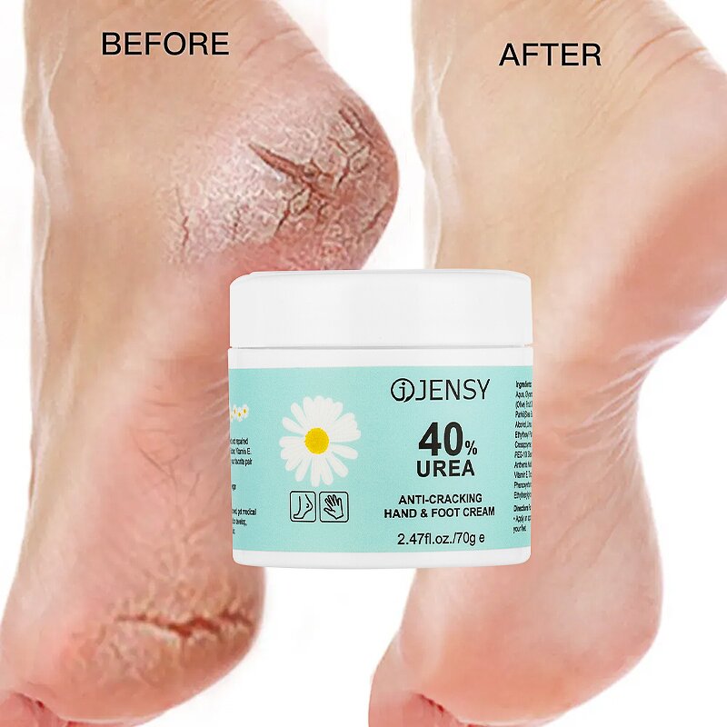 Foot Cream Manufacturer - Anti Crack Exfoliating