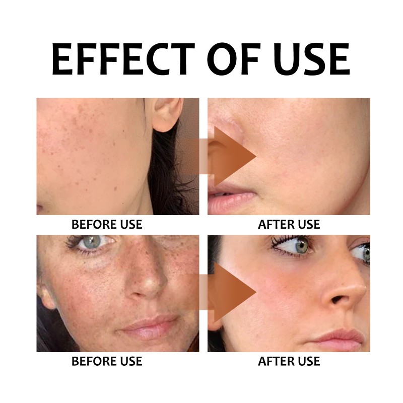 Lemon Soap Manufacturer - OEM Ouhoe Turmeric Acid Deep Cleaning Brightening Exfoliating