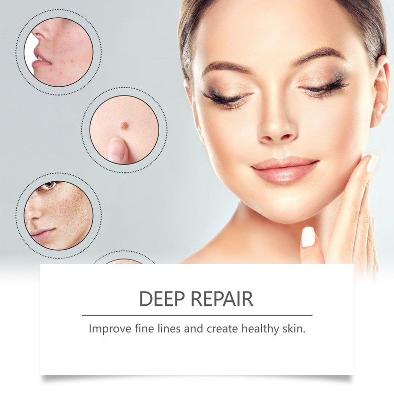 Anti-Snoring Stickers Manufacturer - Bulk Ximonth Night Reduce Snoring Gentle Care Calm Paster