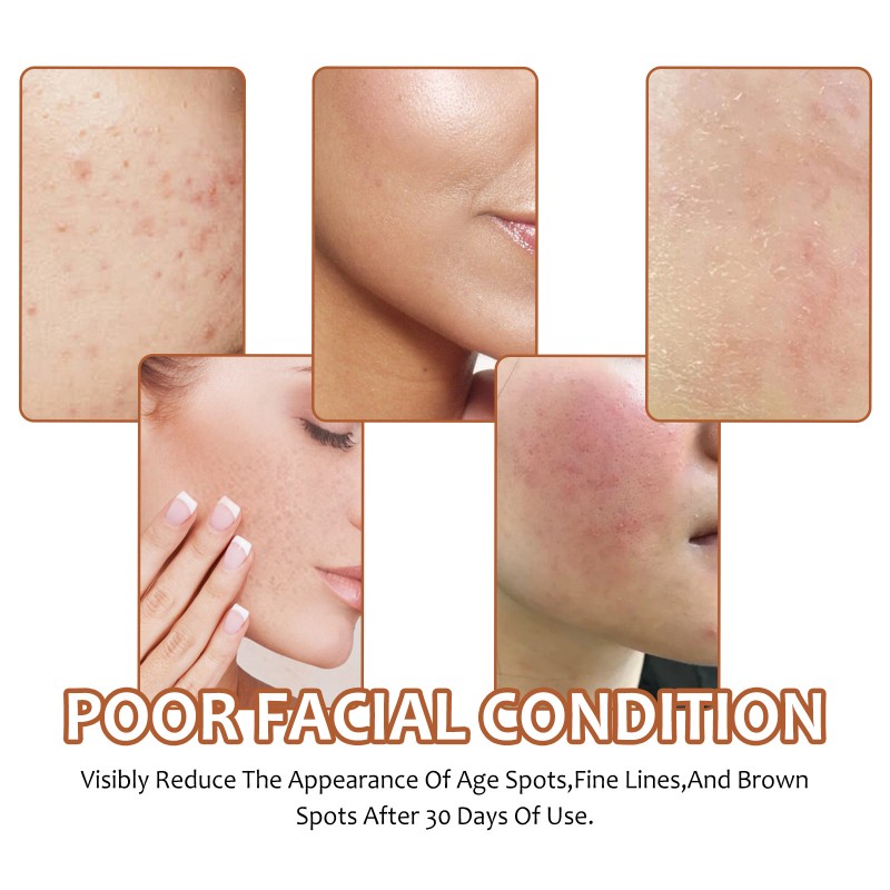 Lemon Soap Manufacturer - OEM Ouhoe Turmeric Acid Deep Cleaning Brightening Exfoliating