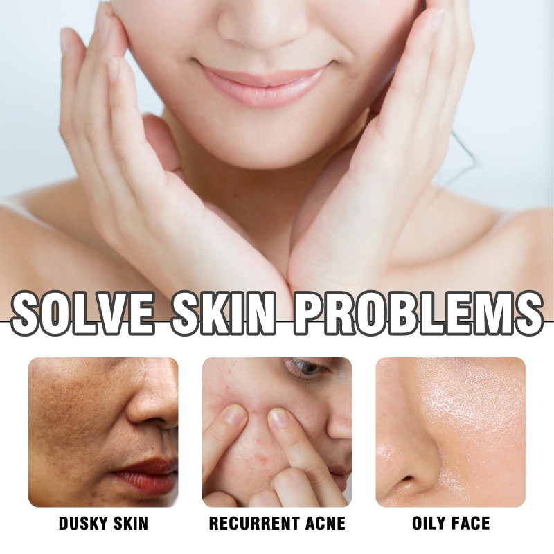 Lavender Soap Factory - Bulk Ximonth Cleaning Soap Pores Oil Control Acne Moisturizing