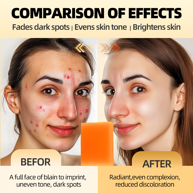 Kojic Acid Soap Manufacturer - Best-Selling 100g Handmade Organic Plant Bath Lightening