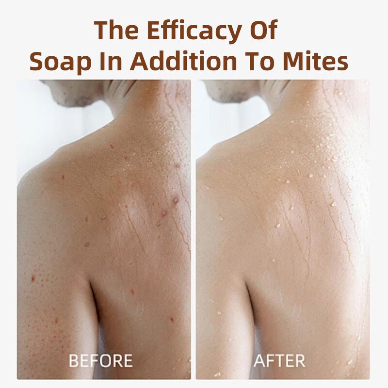 Anti-Acne Kojic Acid Soap Manufacturer - Custom 100g Lemon Fragrance Handmade Skin Care