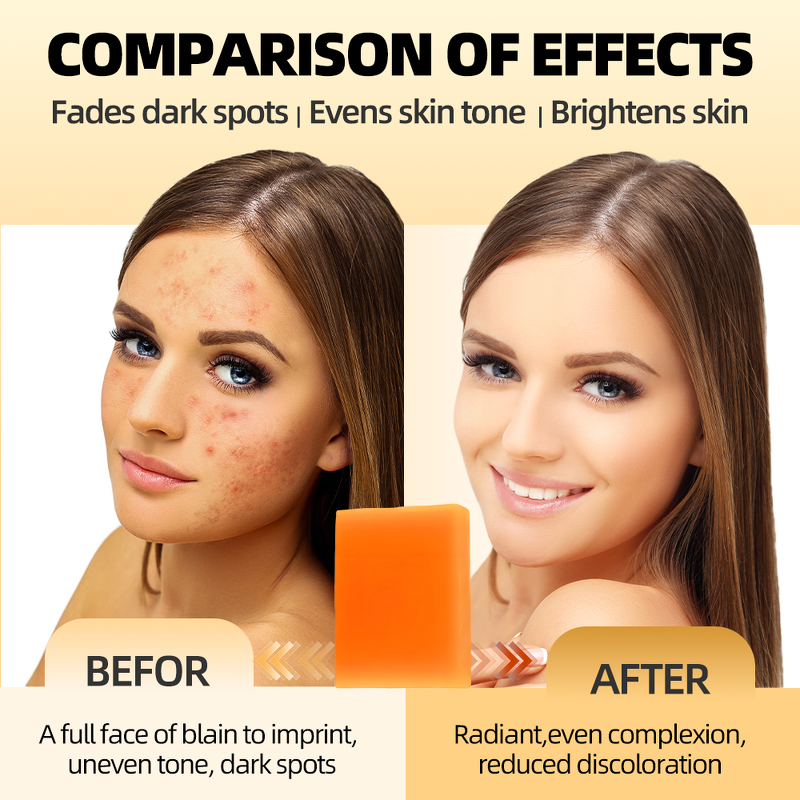 Kojic Acid Soap Manufacturer - Best-Selling 100g Handmade Organic Plant Bath Lightening