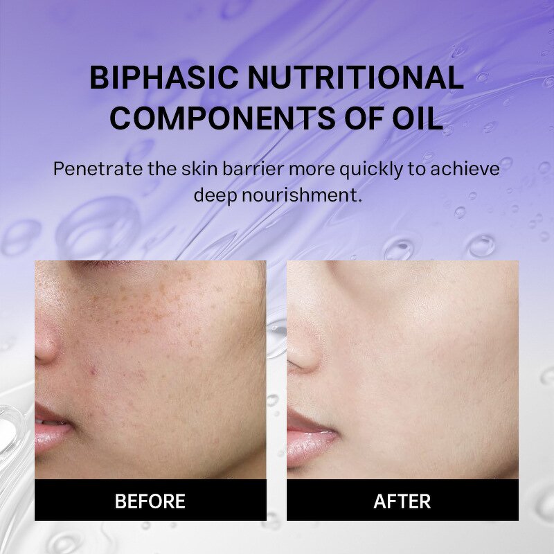 Essence Spray Manufacturer - Anti-aging with Organic Ceramide Radiant Skin