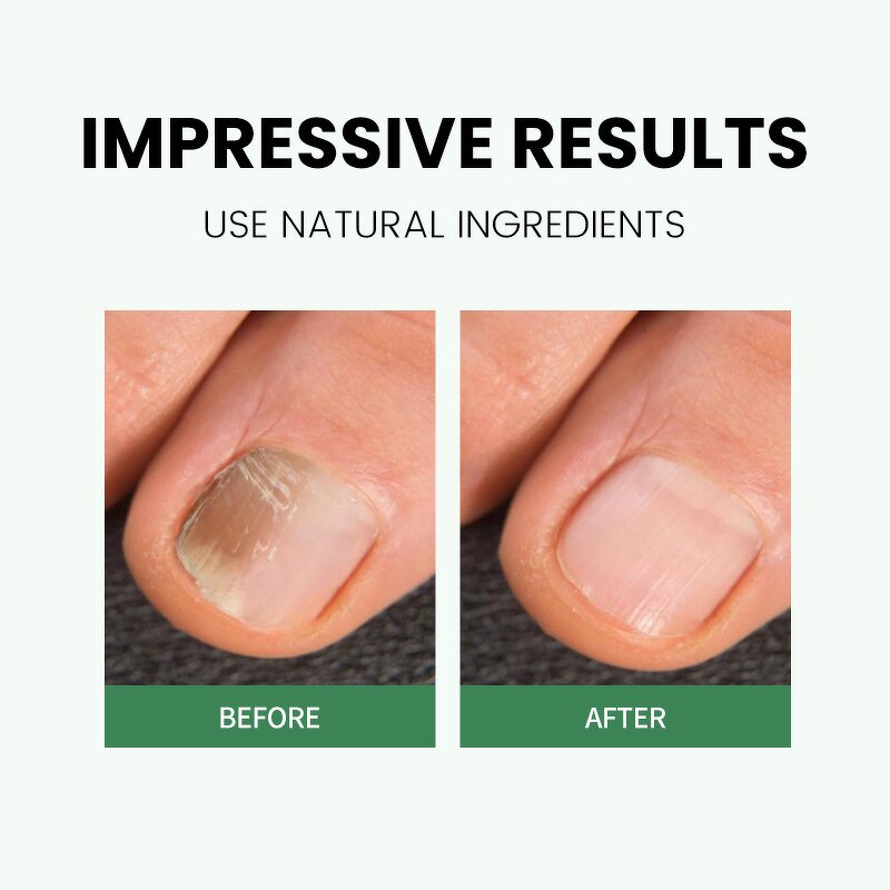 Cuticle Pen Manufacturer - 4-Pack Unscented Nail Oil Treatment Growth