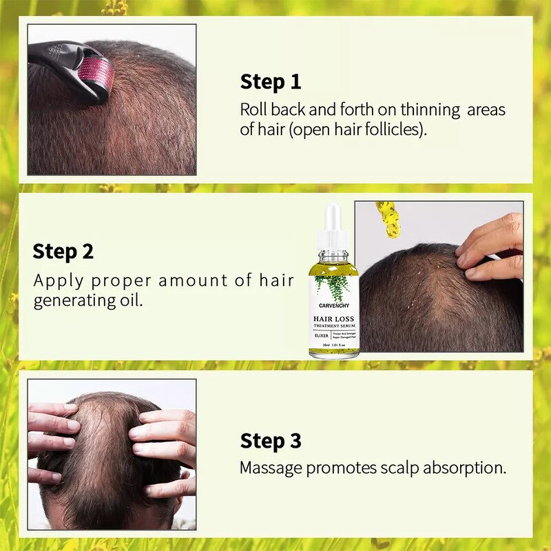 Essential Oil Manufacturer - Wholesale Private Label Organic Rosemary Hair Growth