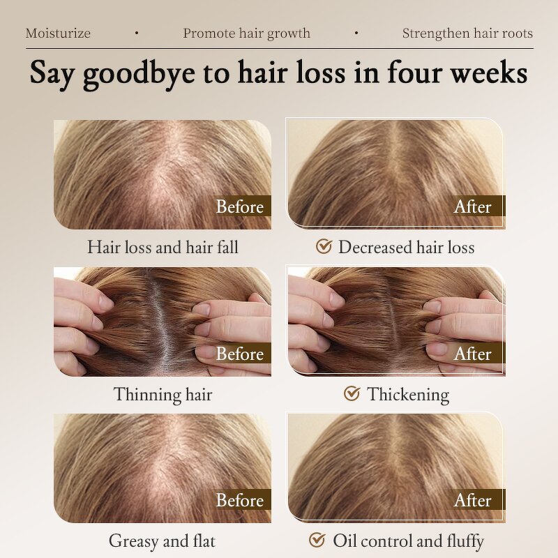 Ginger Hair Serum Factory - Anti-hair Loss Regrowth 30ml