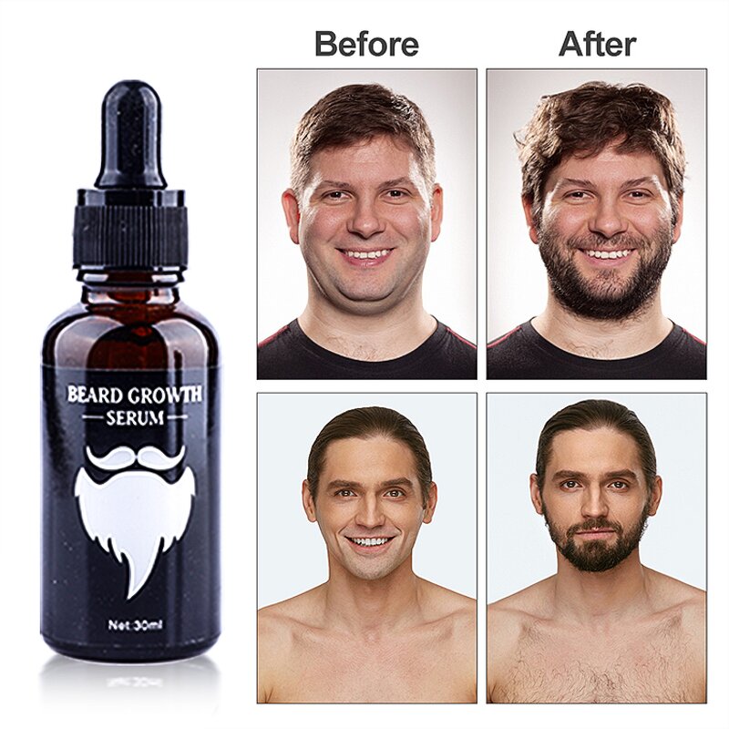 Beard Care Kit Manufacturer - OEM Men's Grooming Herbal Oil