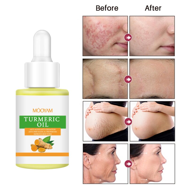 Turmeric Essential Oil Manufacturer - Private Label Aromatherapy Massage