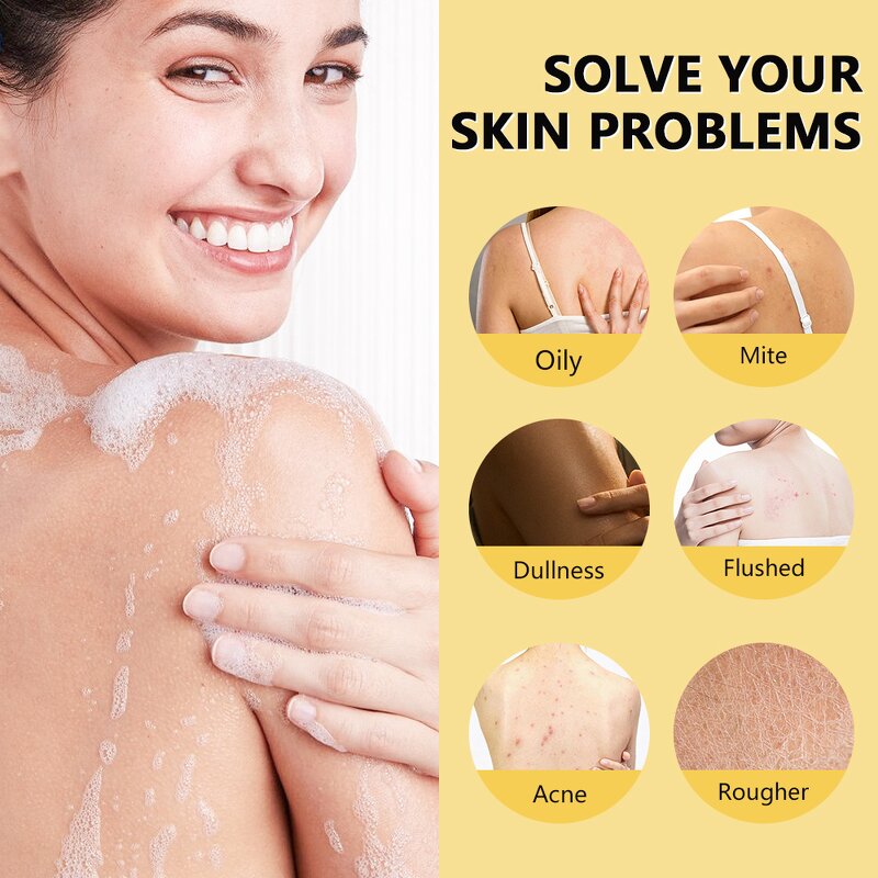 Sulphur Shower Gel Factory - Wholesale 500ml Herbal Cleanse