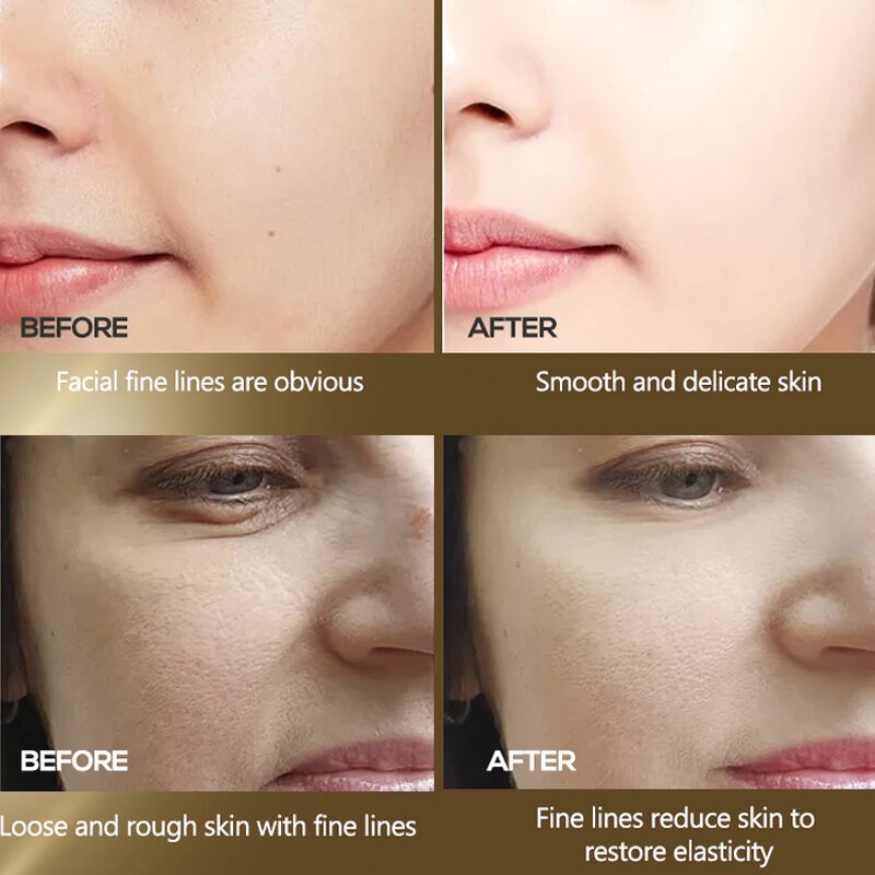 Facial Toner Manufacturer - Vitamin C Turmeric Anti-acne