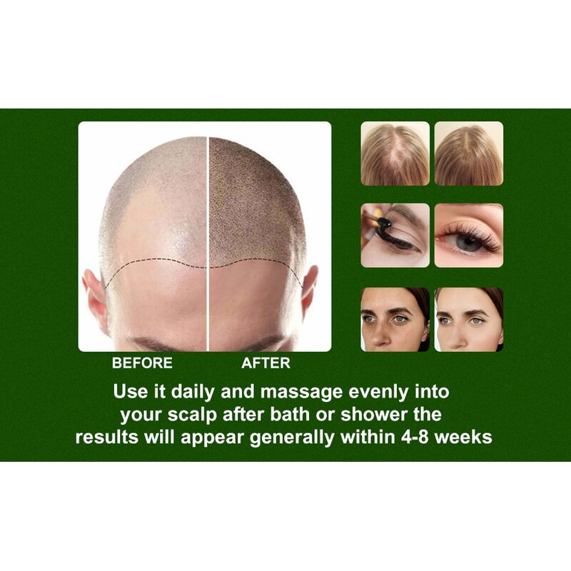 Hair Growth Serum Manufacturer - Organic Argan Oil 30ml