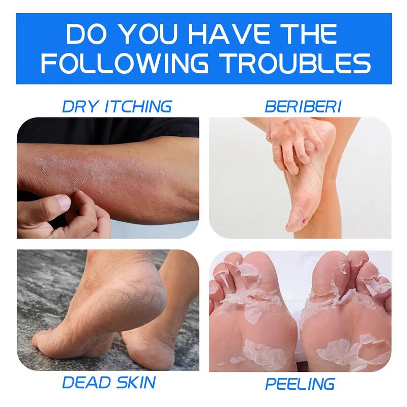 Callus Remover Manufacturer - OEM Private Label Dead Skin Removal Cracked Foot