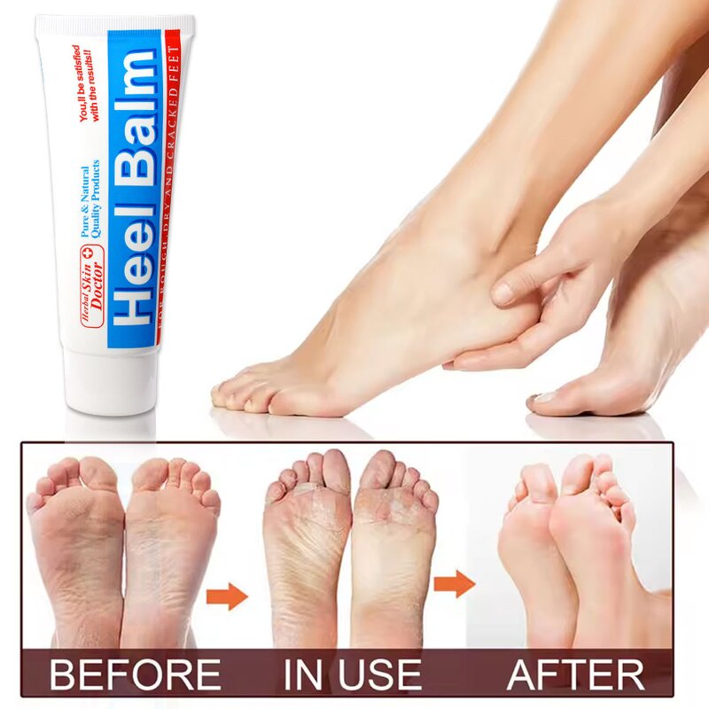 Callus Remover Manufacturer - OEM Private Label Dead Skin Removal Cracked Foot