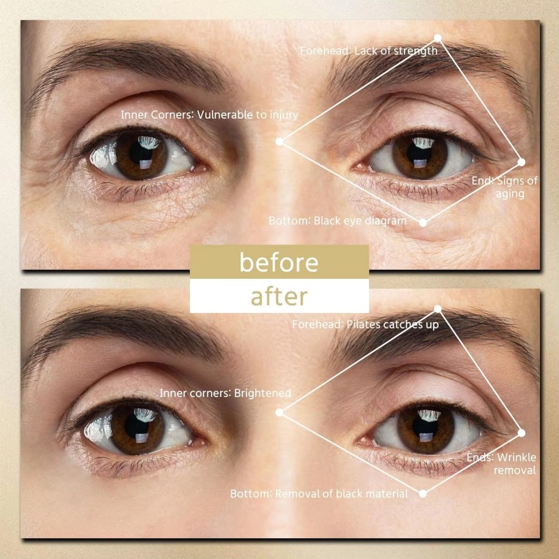 Under Eye Pad Supplier - OEM Reusable Anti-Aging Eye Bag Wrinkle Dark Circles Remover