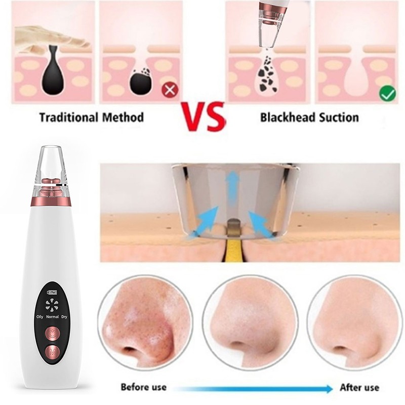 Blackhead Remover Vacuum Factory - OEM 3 Color Light Skin Care Acne Pimples Treatment Hot