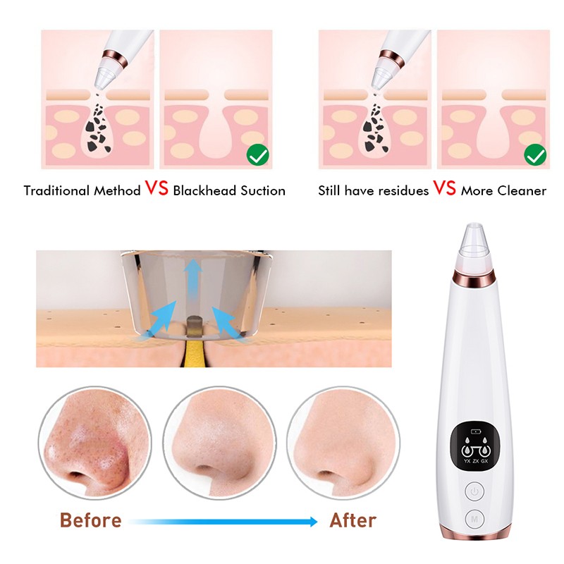 Electric Pore Cleaner Manufacturer - Bulk 2020 5 in 1 Probes Deep Facial Skin Cleaning Usb