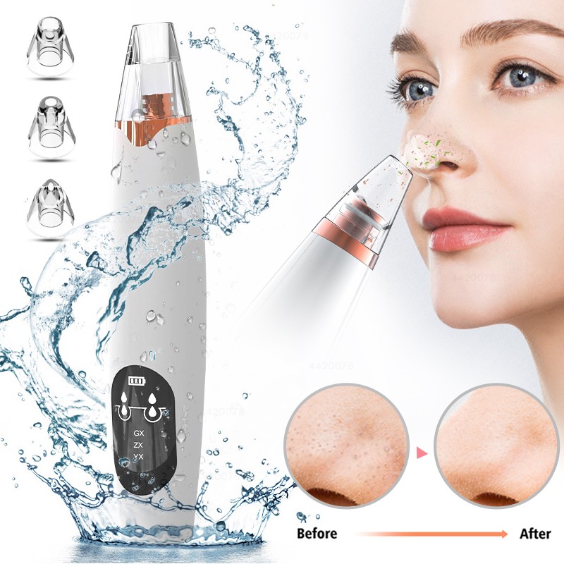 Electric Pore Cleaner Manufacturer - Bulk 2020 5 in 1 Probes Deep Facial Skin Cleaning Usb