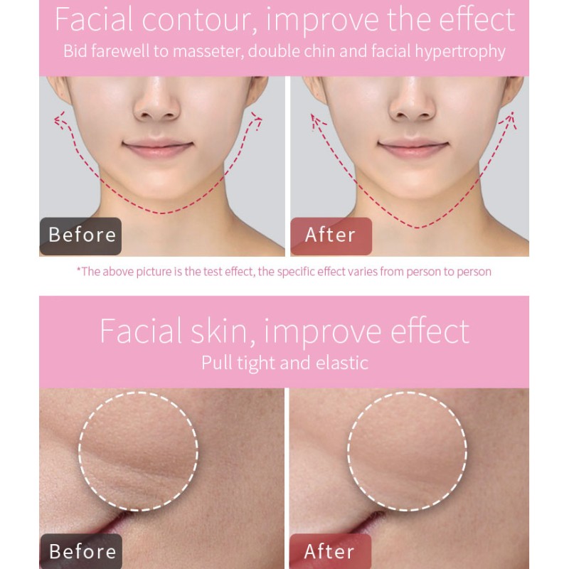 Microcurrent Facial Device Manufacturer - OEM Korea Pure Skin Tightening Machine