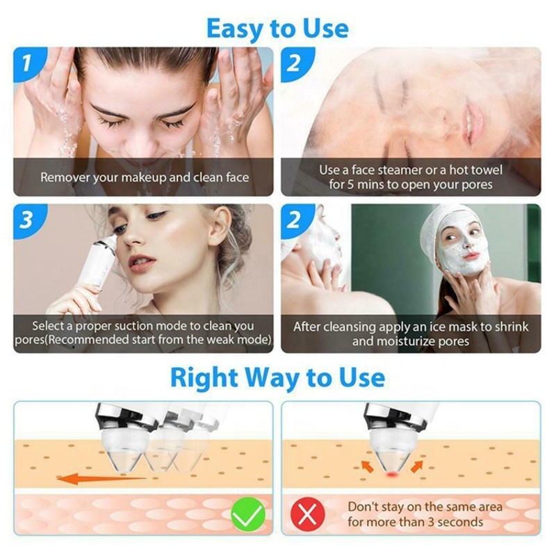 Blackhead Remover Vacuum Supplier - Bulk Small Bubble Acne Comedone Extractor Hot Cold Water