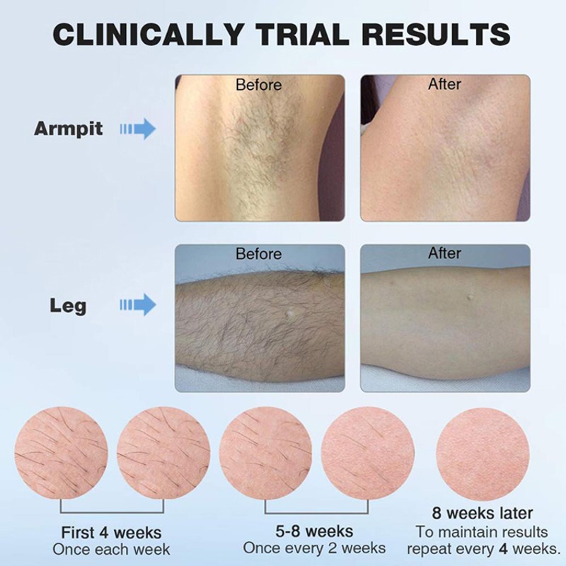 Lipstick Epilator Supplier - Bulk Shaver Small Electric Portable Painless Ladies Facial