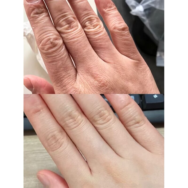 Nail Beauty Hand Care Cabin Manufacturer - Whitening Tender Hand Red & Blue Light Regeneration