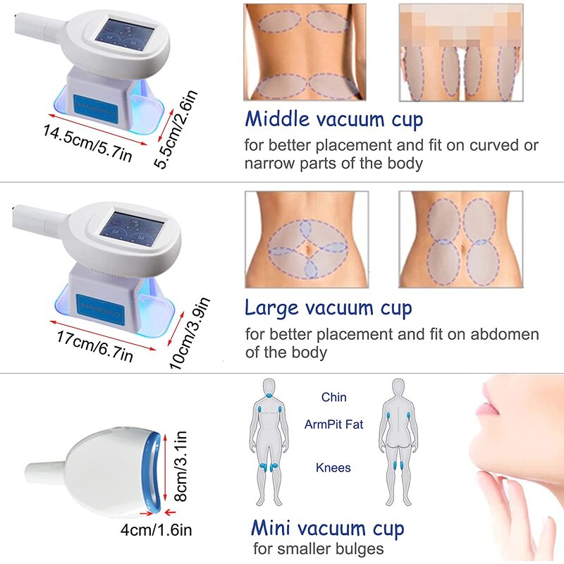 Cryotherapy Fat Freezing Machine Factory - 2024z Newest 3 Handles 360 Cryo Slim Contouring