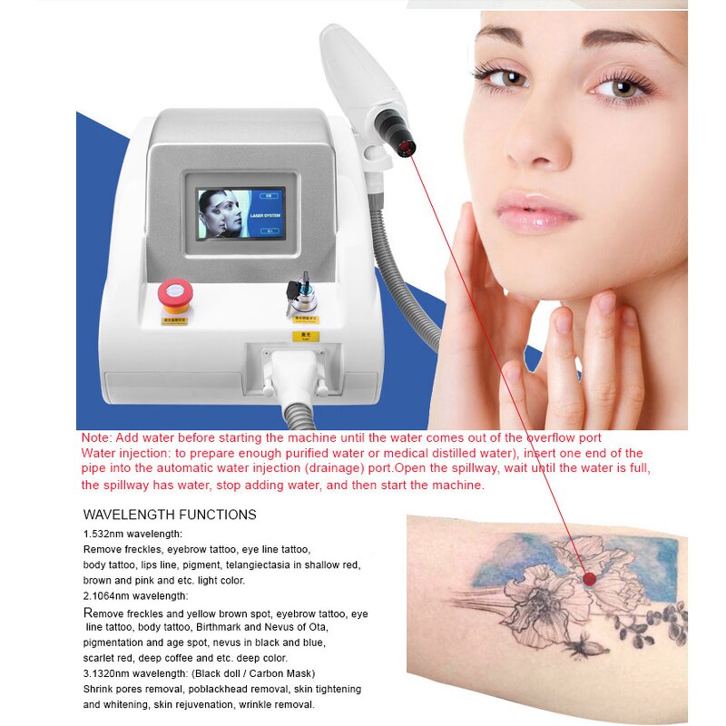 Carbon Peel Laser Machine Manufacturer - Hot Y Q Switched ND YAG Tattoo Removal