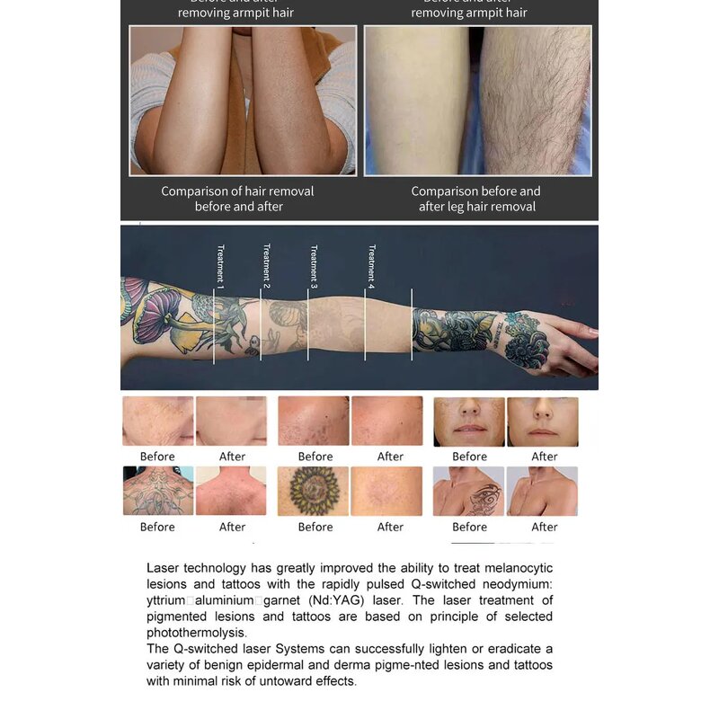 Hydro Facial Machine Manufacturer - A Small Bubble 14 in 1 H2o2 Dermabrasion Beauty Clinic