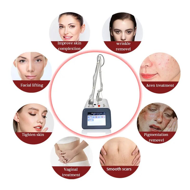 Red Blood Vessel Removal Machine Factory - 980nm 5in1y High Frequency Spider Vein Anti-red