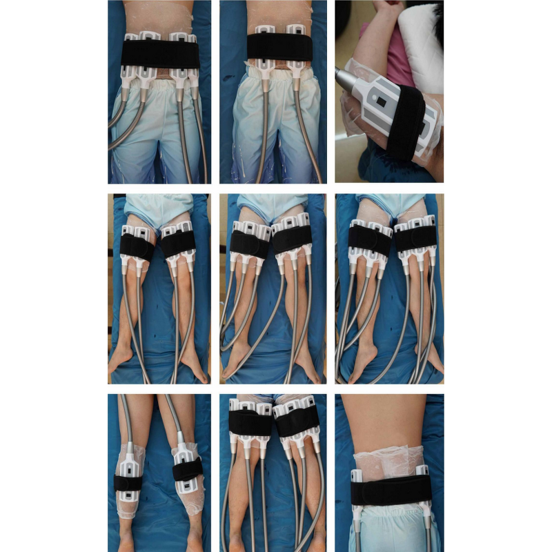 Hydra Dermabrasion Machine Factory - ZS Manufacturer 9-in-1 Smart Skincare Micro Bubble