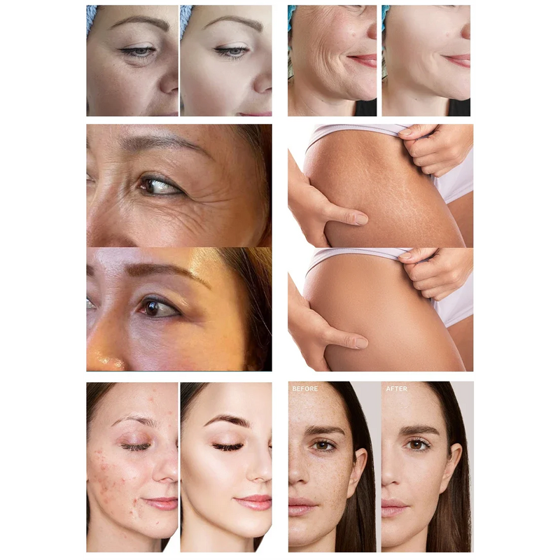 Red Light Therapy Device Manufacturer - Medical Grade LED Facial 4 Modes Near Infrared PDT