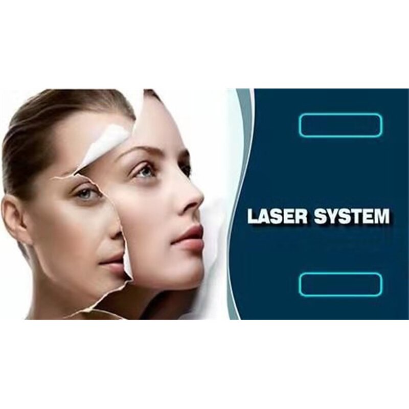 Permanent Freckles Remover Manufacturer - Black Pigment Removal Carbon Peeling Skin