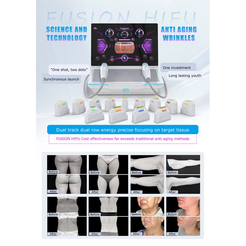 7-in-1 Professional Beauty Machine Manufacturer - GZ RF + HIFU + Vaginal Tightening