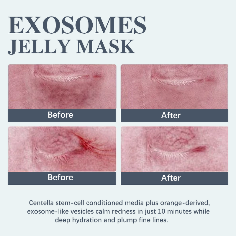 SPA Face Whitening Mask Manufacturer - Private Natural Exosomes Jelly for Wrinkle Hydrating