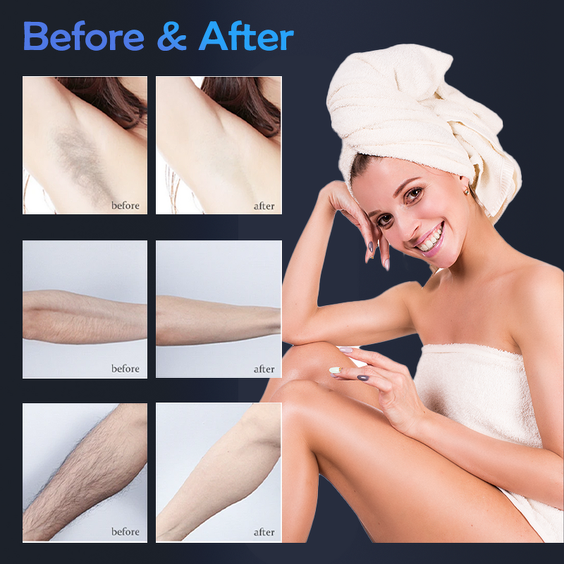 2in1 Laser Machine Manufacturer - G 808+Picosecond Tattoo Removal Light Scar Acne