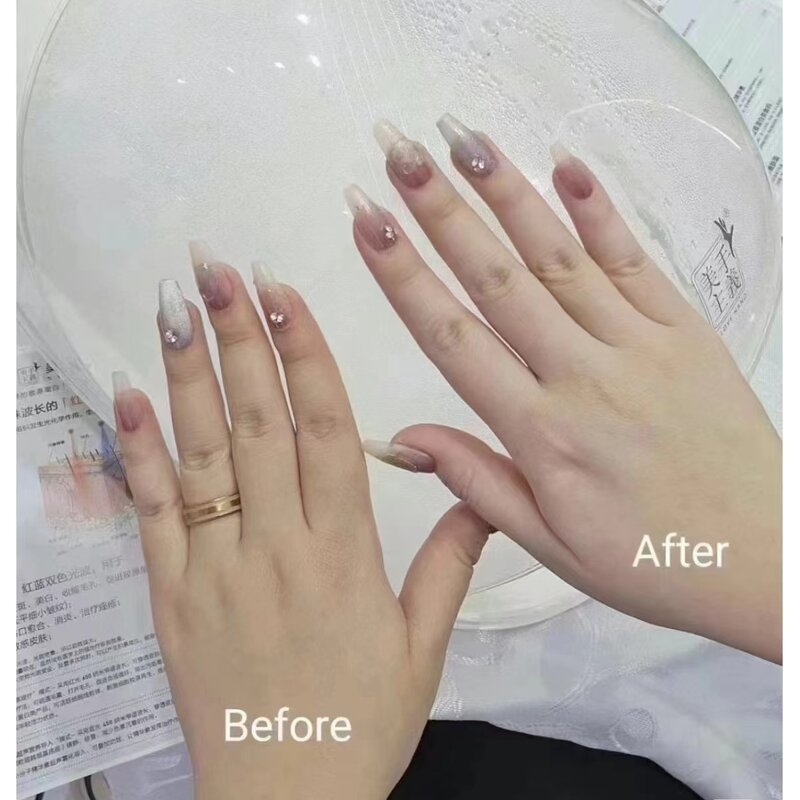 1927nm Beauty Machine Manufacturer - T New Arrival Fine Lines Scar Removal Skin Tightening