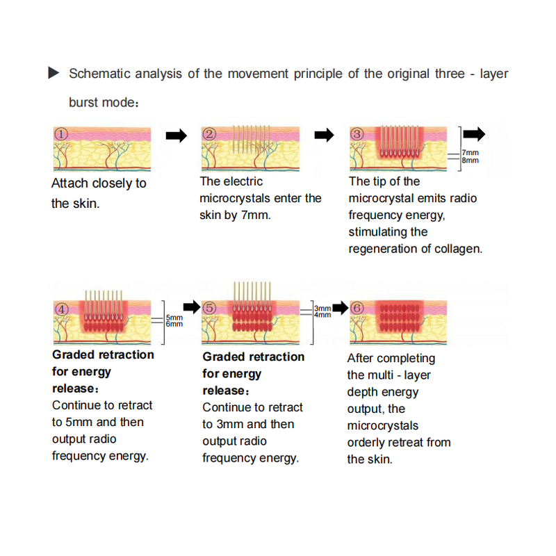 Professional Handheld RF Machine Factory - Face Body Treatment Mesotherapy Wrinkle Removal