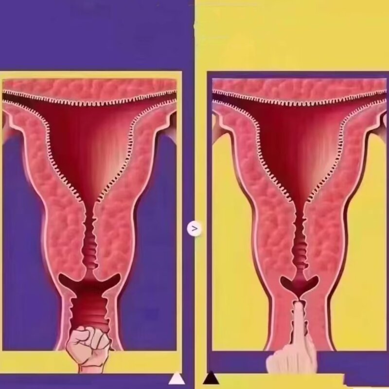 12D HIFU Beauty SPA Machine Factory - Body Tightening Burning Fat Skin Firming Sculpt