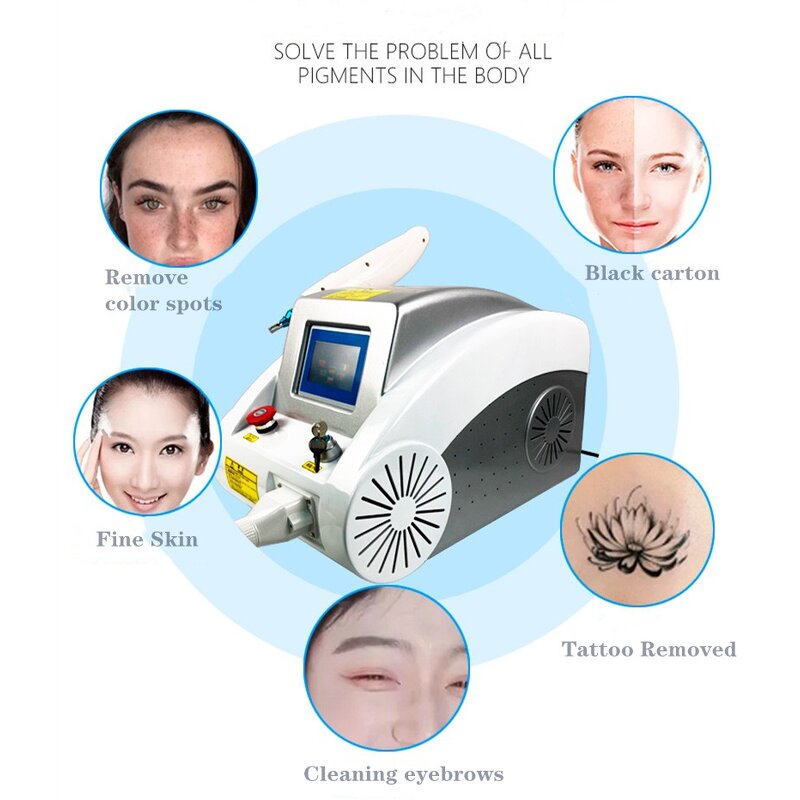 Carbon Peel Laser Machine Manufacturer - Hot Y Q Switched ND YAG Tattoo Removal