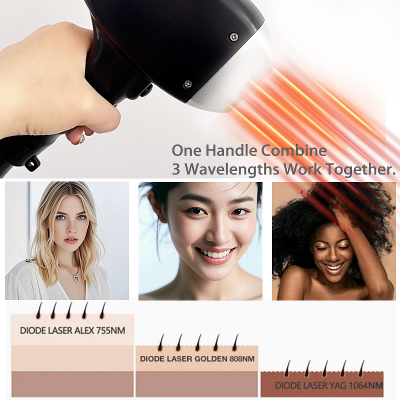 Diode Laser Hair Removal Machine Manufacturer - G Laser Best Professional 755 808 1064nm