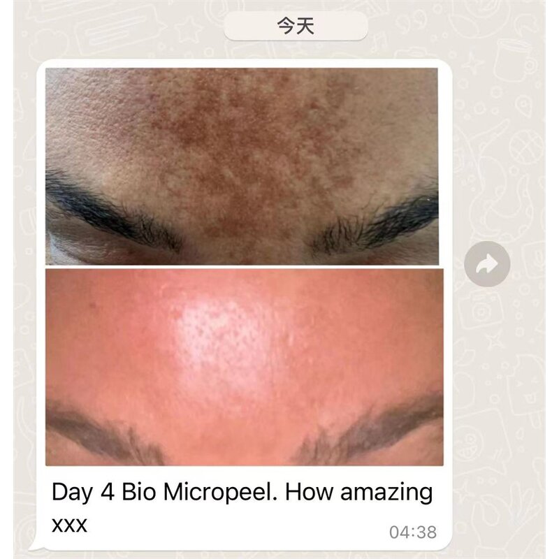 Seaweed Exfoliating Kit Manufacturer - G for Whitening Melasma Acne Treatment Hydrating Firming