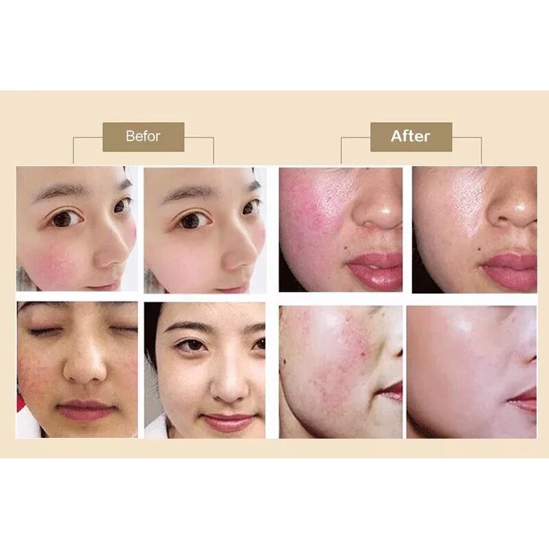 Magnetic Body Toning Machine Factory - Non-Invasive 13 Tesla Power